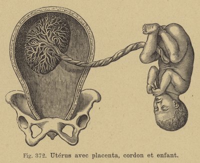 Corte transversal de un útero mostrando la placenta, el cordón umbilical y el bebé de German School
